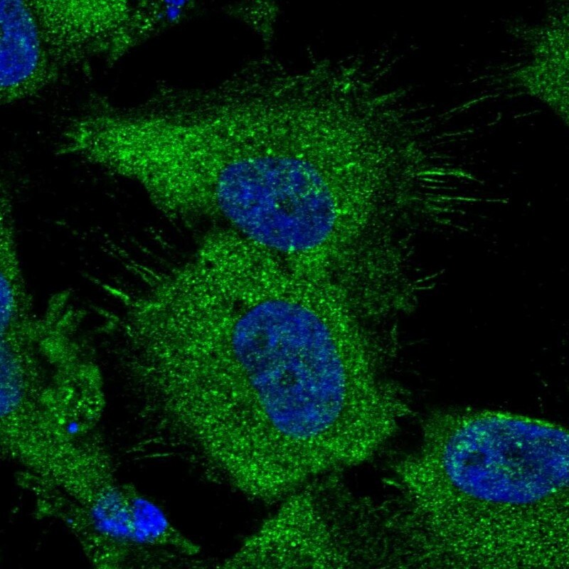 ATP Citrate Lyase Antibody - BSA Free Immunocytochemistry/ Immunofluorescence: ATP Citrate Lyase Antibody [NBP1-90267]