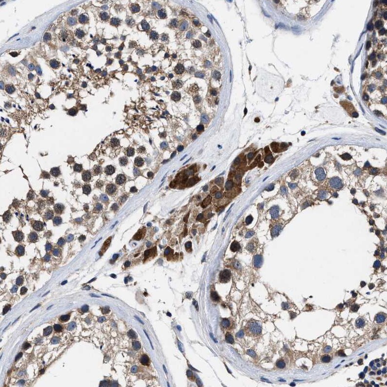 ATP Citrate Lyase Antibody - BSA Free Immunohistochemistry-Paraffin: ATP Citrate Lyase Antibody [NBP1-90267]