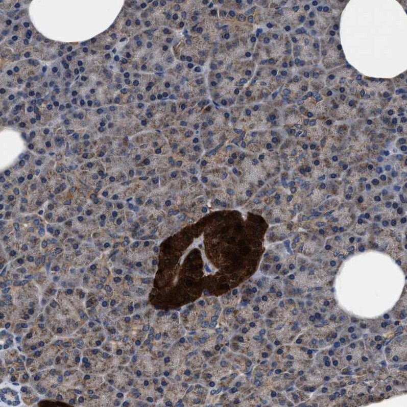 ATP Citrate Lyase Antibody - BSA Free Immunohistochemistry-Paraffin: ATP Citrate Lyase Antibody [NBP1-90267]