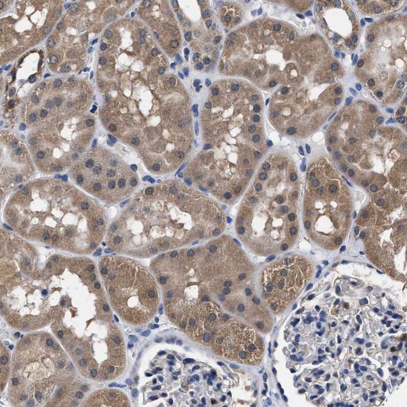 ATP Citrate Lyase Antibody - BSA Free Immunohistochemistry-Paraffin: ATP Citrate Lyase Antibody [NBP1-90267]