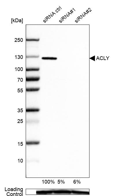 ATP Citrate Lyase Antibody - BSA Free Western Blot: ATP Citrate Lyase Antibody - BSA Free [NBP1-90267]