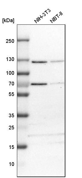 ATP Citrate Lyase Antibody - BSA Free Western Blot: ATP Citrate Lyase Antibody - BSA Free [NBP1-90267]