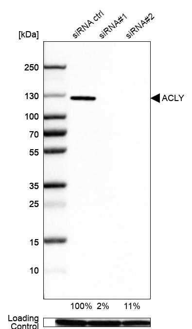 ATP Citrate Lyase Antibody - BSA Free Western Blot: ATP Citrate Lyase Antibody - BSA Free [NBP1-90268]