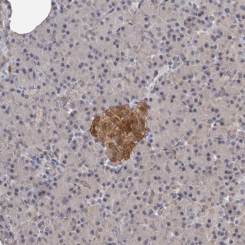 ATP Citrate Lyase Antibody - BSA Free Immunohistochemistry: ATP Citrate Lyase Antibody - BSA Free [NBP1-90269]