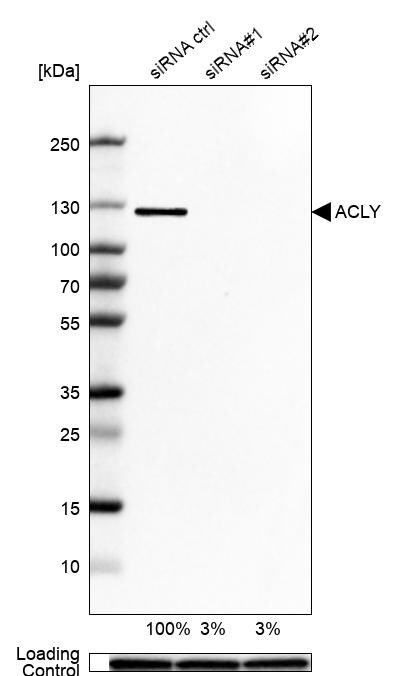 ATP Citrate Lyase Antibody - BSA Free Western Blot: ATP Citrate Lyase Antibody - BSA Free [NBP1-90269]