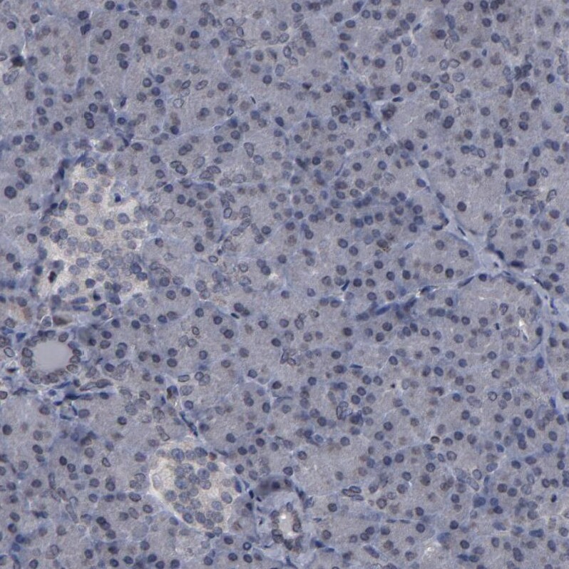 ACF1 Antibody - BSA Free Immunohistochemistry: ACF1 Antibody - BSA Free [NBP1-90270]