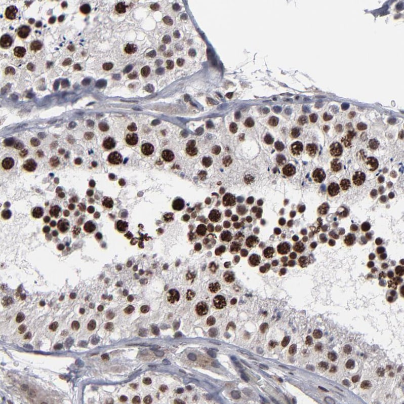 ACF1 Antibody - BSA Free Immunohistochemistry: ACF1 Antibody - BSA Free [NBP1-90270]