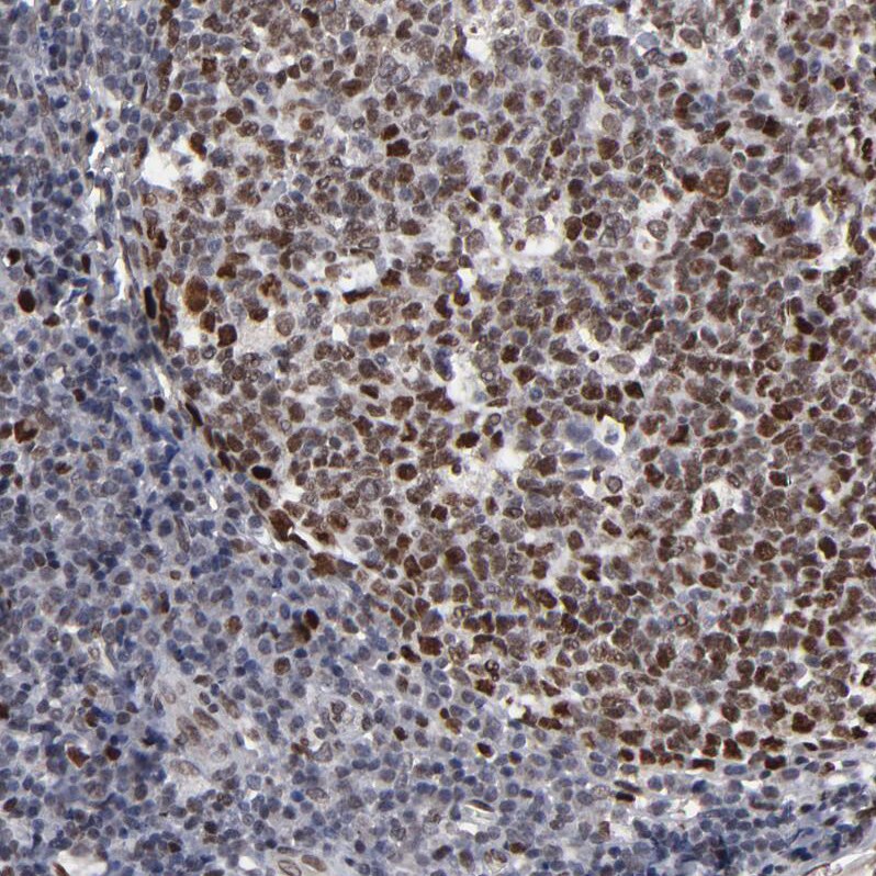 ACF1 Antibody - BSA Free Immunohistochemistry: ACF1 Antibody - BSA Free [NBP1-90270]