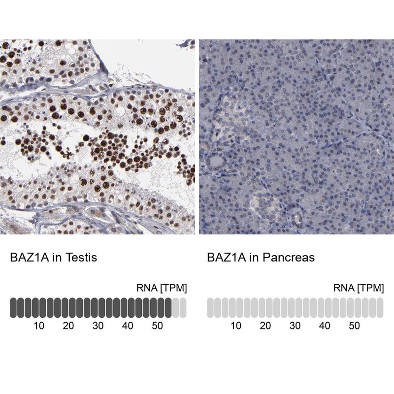 ACF1 Antibody - BSA Free Immunohistochemistry: ACF1 Antibody - BSA Free [NBP1-90270]