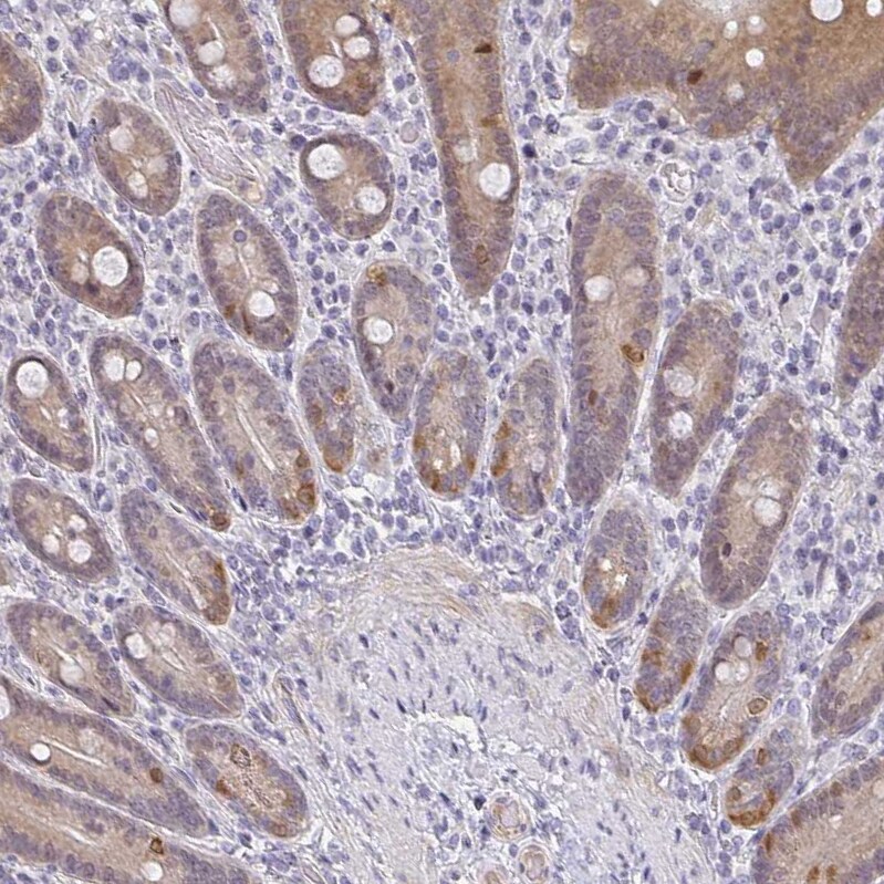 ACF Antibody - BSA Free Immunohistochemistry: ACF Antibody - BSA Free [NBP1-90271]