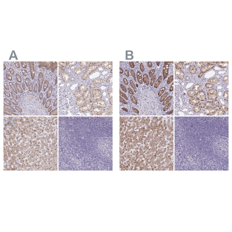 ACF Antibody - BSA Free Immunohistochemistry: ACF Antibody - BSA Free [NBP1-90271]
