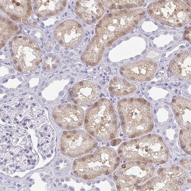 ACF Antibody - BSA Free Immunohistochemistry: ACF Antibody - BSA Free [NBP1-90271]