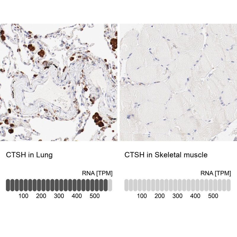 Cathepsin H Antibody - BSA Free Immunohistochemistry: Cathepsin H Antibody - BSA Free [NBP1-90273]