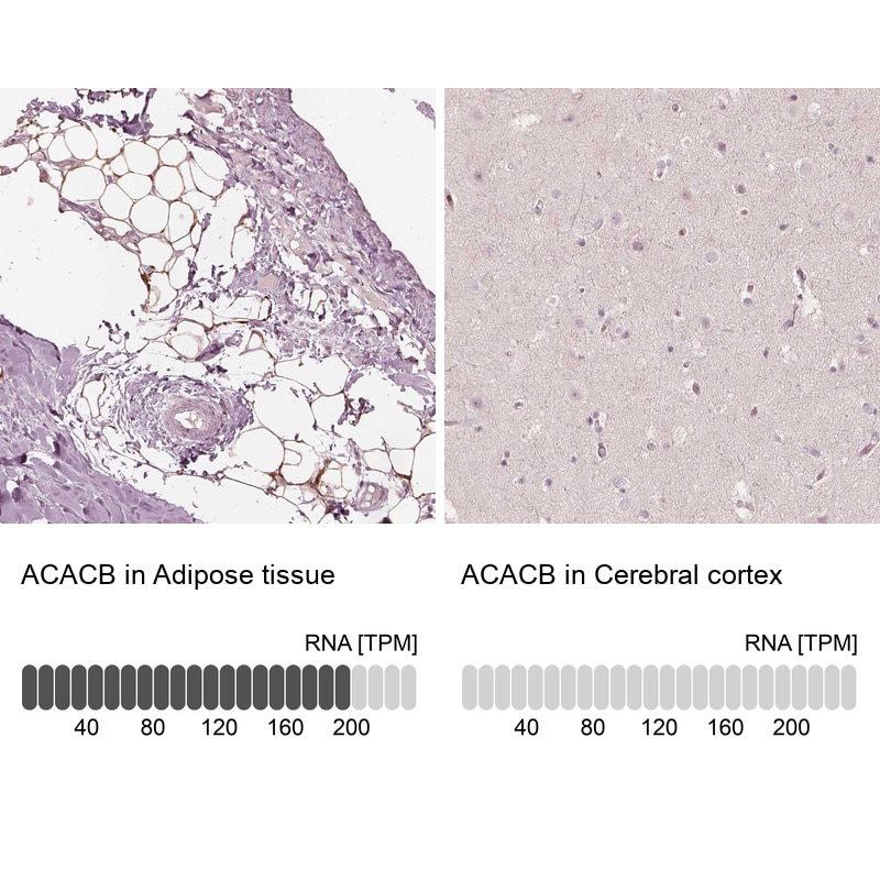 Acetyl Coenzyme A Carboxylase Beta Antibody - BSA Free Immunohistochemistry: Acetyl Coenzyme A Carboxylase Beta Antibody - BSA Free [NBP1-90274]