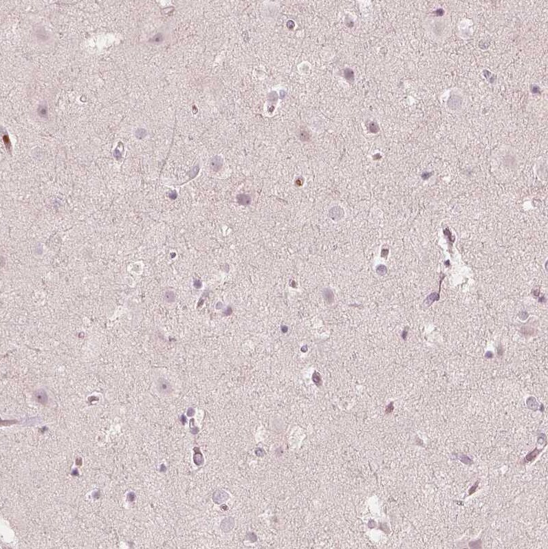 Acetyl Coenzyme A Carboxylase Beta Antibody - BSA Free Immunohistochemistry: Acetyl Coenzyme A Carboxylase Beta Antibody - BSA Free [NBP1-90274]