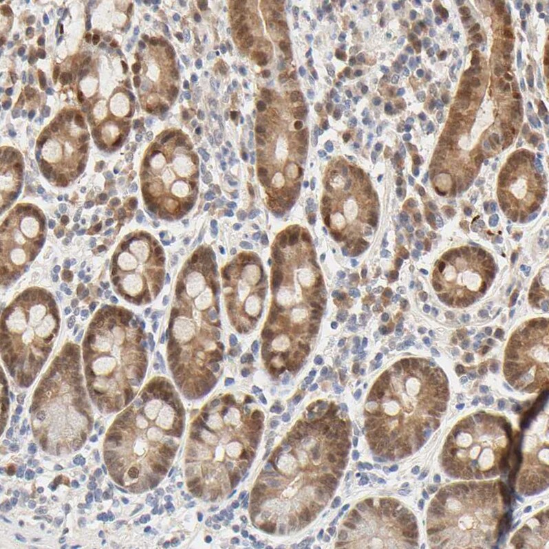 Acetyl CoA synthetase Antibody - BSA Free Immunohistochemistry: Acetyl CoA synthetase Antibody - BSA Free [NBP1-90276]