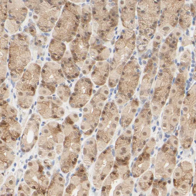 Acetyl CoA synthetase Antibody - BSA Free Immunohistochemistry: Acetyl CoA synthetase Antibody - BSA Free [NBP1-90276]