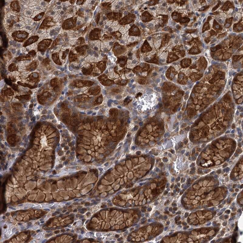 Adenylate Cyclase 2 Antibody - BSA Free Immunohistochemistry: Adenylate Cyclase 2 Antibody - BSA Free [NBP1-90280]