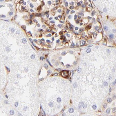 Filamin A Antibody - BSA Free Immunohistochemistry: Filamin A Antibody - BSA Free [NBP1-90283]