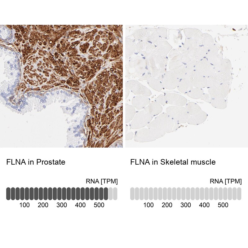 Filamin A Antibody - BSA Free Immunohistochemistry: Filamin A Antibody - BSA Free [NBP1-90283]