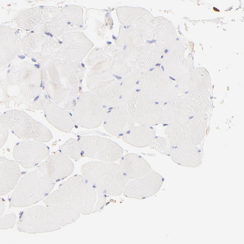Filamin A Antibody - BSA Free Immunohistochemistry: Filamin A Antibody - BSA Free [NBP1-90283]