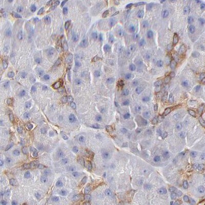 Filamin A Antibody - BSA Free Immunohistochemistry: Filamin A Antibody - BSA Free [NBP1-90283]