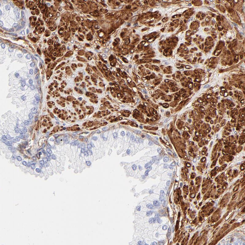 Filamin A Antibody - BSA Free Immunohistochemistry: Filamin A Antibody - BSA Free [NBP1-90283]