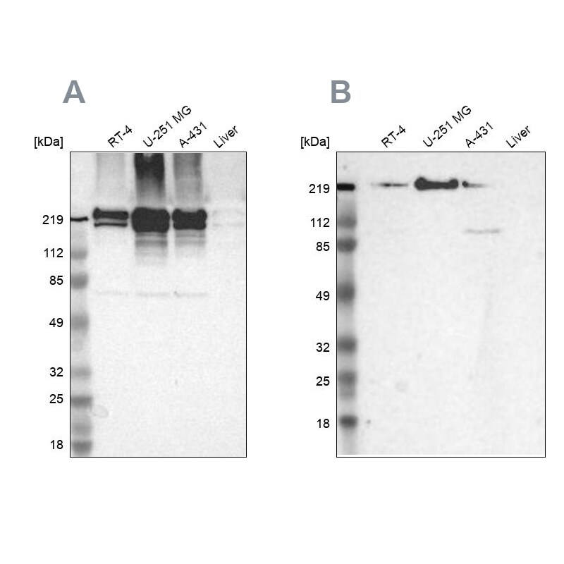 Filamin A Antibody - BSA Free Western Blot: Filamin A Antibody - BSA Free [NBP1-90283]