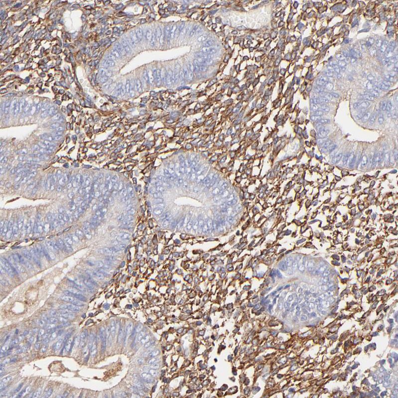 Filamin A Antibody - BSA Free Immunohistochemistry: Filamin A Antibody - BSA Free [NBP1-90283]