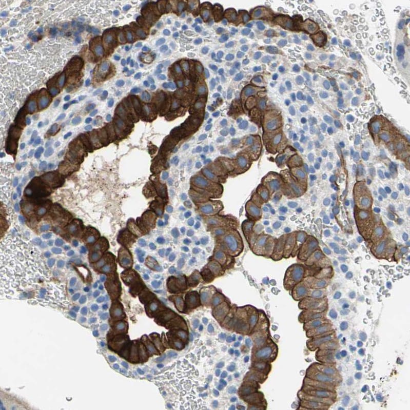 Filamin B Antibody - BSA Free Immunohistochemistry: Filamin B Antibody - BSA Free [NBP1-90285]