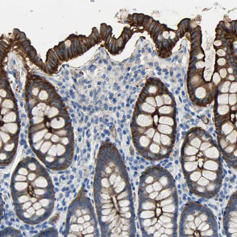 Filamin B Antibody - BSA Free Immunohistochemistry: Filamin B Antibody - BSA Free [NBP1-90285]