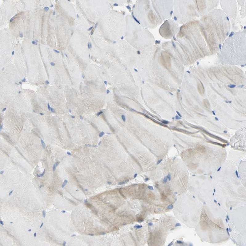 Filamin B Antibody - BSA Free Immunohistochemistry: Filamin B Antibody - BSA Free [NBP1-90285]