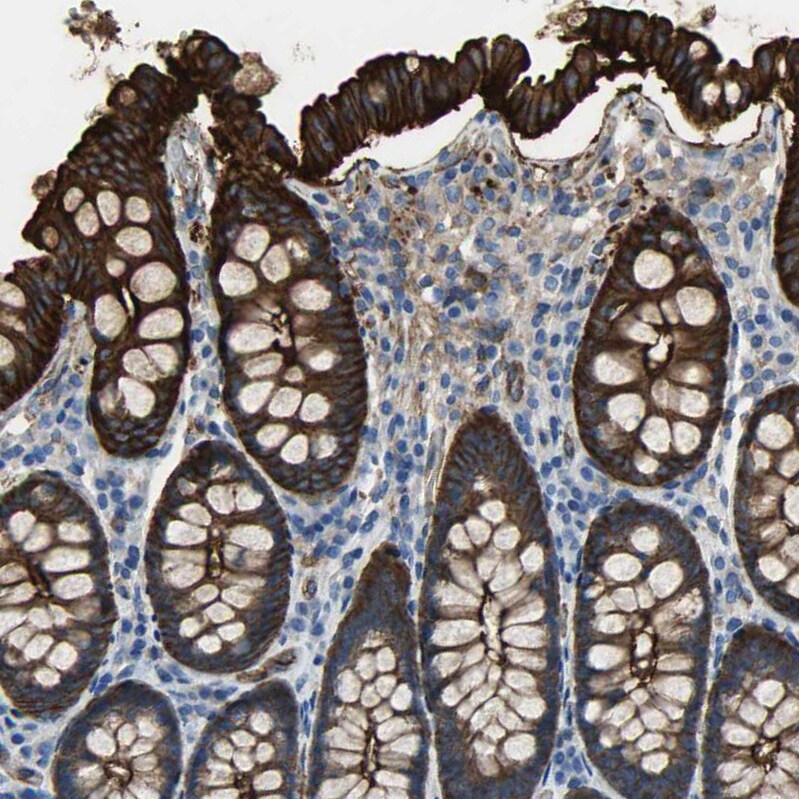 Filamin B Antibody - BSA Free Immunohistochemistry: Filamin B Antibody - BSA Free [NBP1-90286]