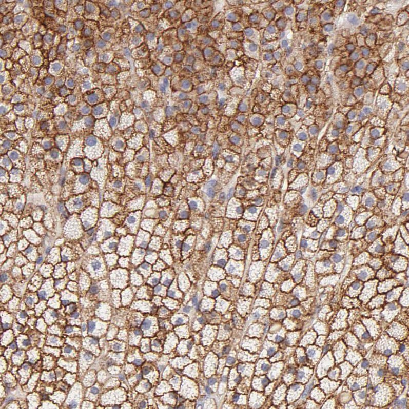 MDR1/ABCB1 Antibody - BSA Free Immunohistochemistry: MDR1/ABCB1 Antibody - BSA Free [NBP1-90291]