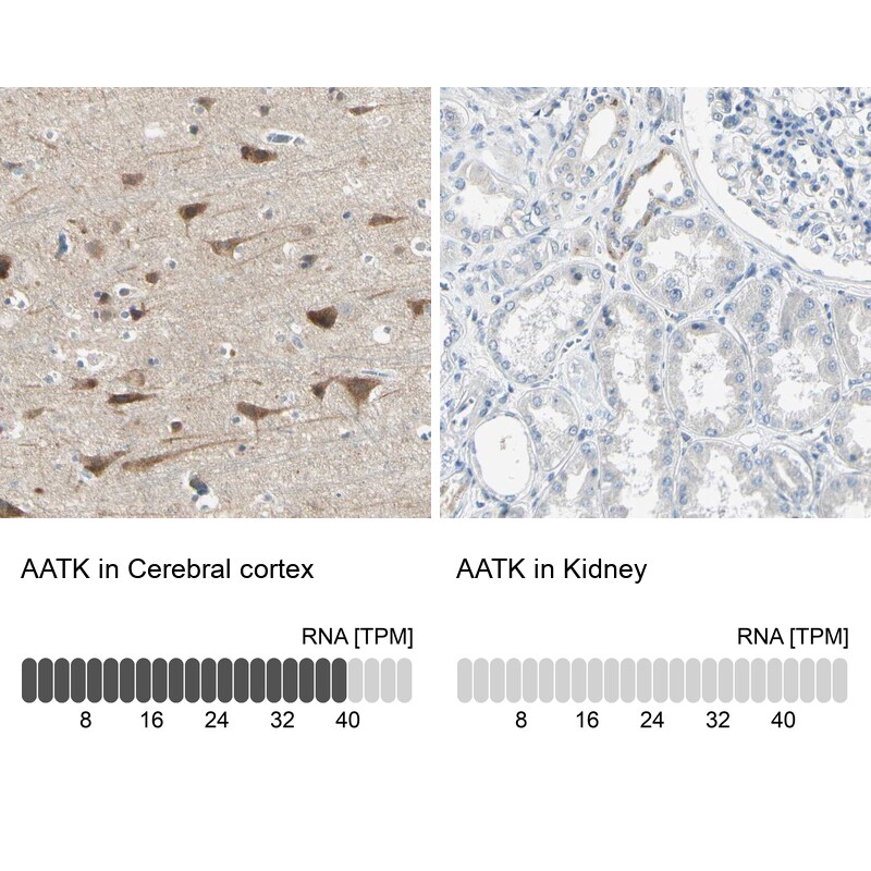 AATK/Serine/threonine-protein kinase LMTK1 Antibody - BSA Free Immunohistochemistry-Paraffin: AATK/Serine/threonine-protein kinase LMTK1 Antibody [NBP1-90292]