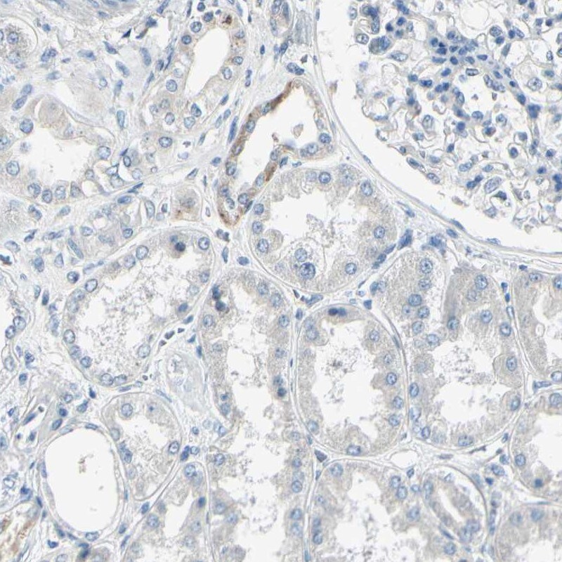 AATK/Serine/threonine-protein kinase LMTK1 Antibody - BSA Free Immunohistochemistry-Paraffin: AATK/Serine/threonine-protein kinase LMTK1 Antibody [NBP1-90292]