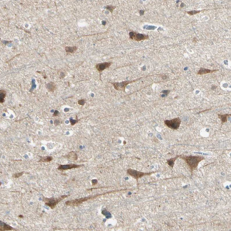 AATK/Serine/threonine-protein kinase LMTK1 Antibody - BSA Free Immunohistochemistry: AATK/Serine/threonine-protein kinase LMTK1 Antibody - BSA Free [NBP1-90292]