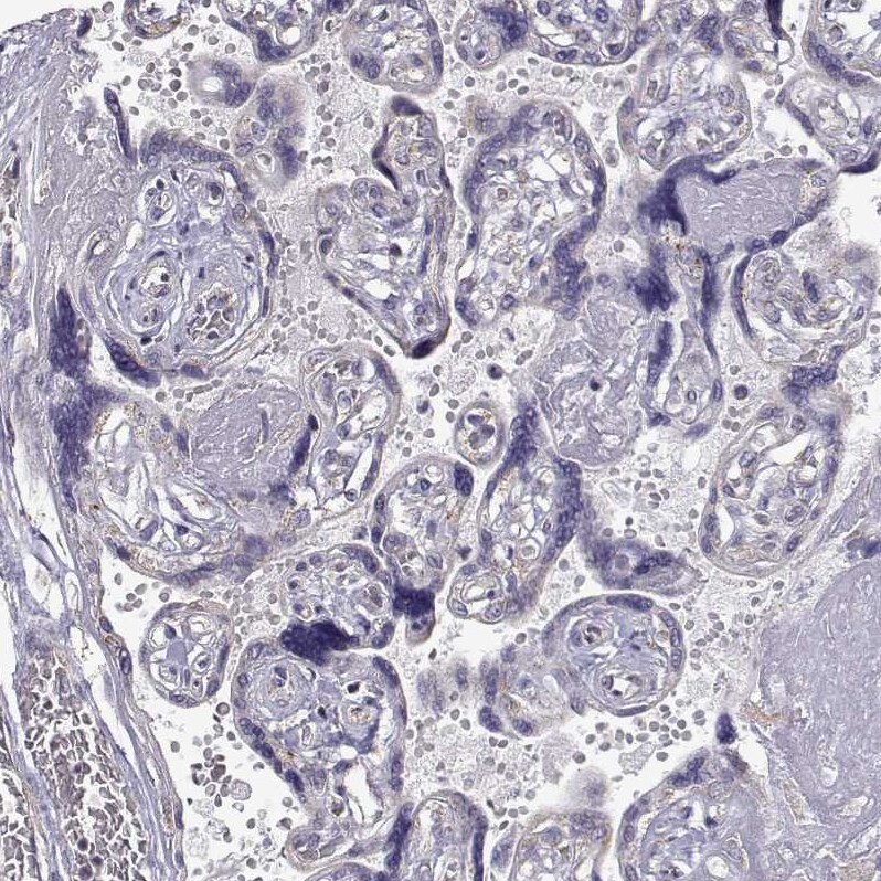 Dopa Decarboxylase/DDC Antibody - BSA Free Immunohistochemistry: Dopa Decarboxylase/DDC Antibody - BSA Free [NBP1-90293]