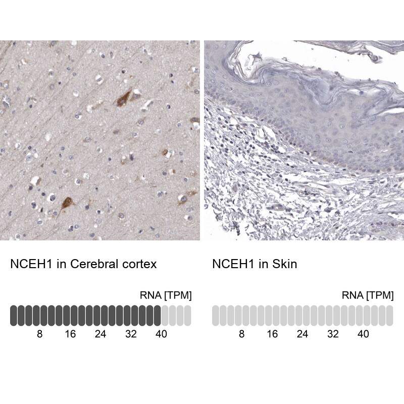AADACL1 Antibody - BSA Free Immunohistochemistry: AADACL1 Antibody - BSA Free [NBP1-90294]