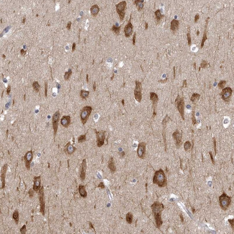 AADACL1 Antibody - BSA Free Immunohistochemistry: AADACL1 Antibody - BSA Free [NBP1-90294]