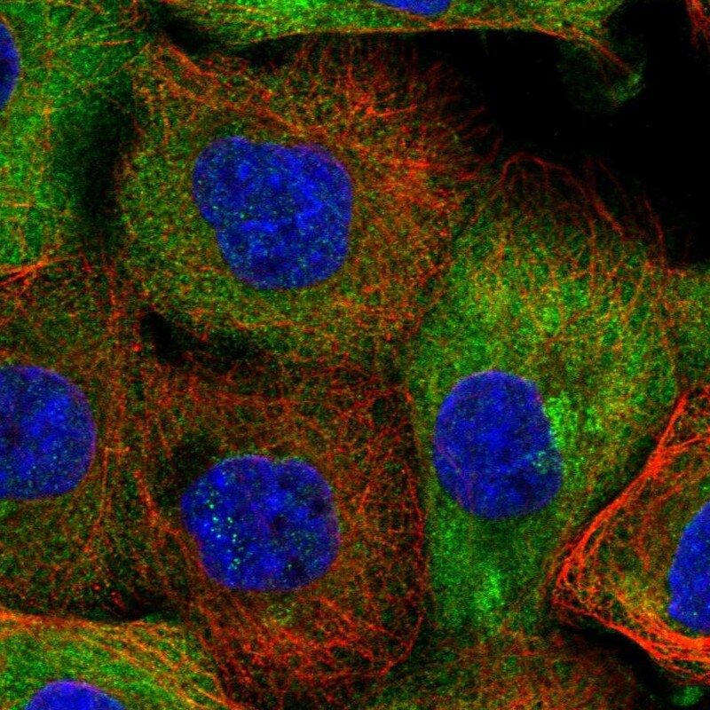 AADACL1 Antibody - BSA Free Immunocytochemistry/ Immunofluorescence: AADACL1 Antibody - BSA Free [NBP1-90294]