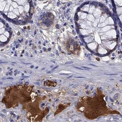 Serpin A3/alpha 1-Antichymotrypsin Antibody - BSA Free Immunohistochemistry: Serpin A3/alpha 1-Antichymotrypsin Antibody - BSA Free [NBP1-90296]