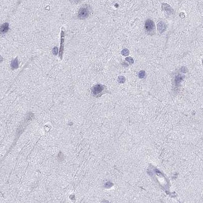 Serpin A3/alpha 1-Antichymotrypsin Antibody - BSA Free Immunohistochemistry: Serpin A3/alpha 1-Antichymotrypsin Antibody - BSA Free [NBP1-90296]