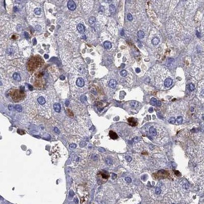 Serpin A3/alpha 1-Antichymotrypsin Antibody - BSA Free Immunohistochemistry: Serpin A3/alpha 1-Antichymotrypsin Antibody - BSA Free [NBP1-90296]