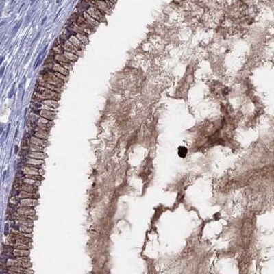 Serpin A3/alpha 1-Antichymotrypsin Antibody - BSA Free Immunohistochemistry: Serpin A3/alpha 1-Antichymotrypsin Antibody - BSA Free [NBP1-90296]