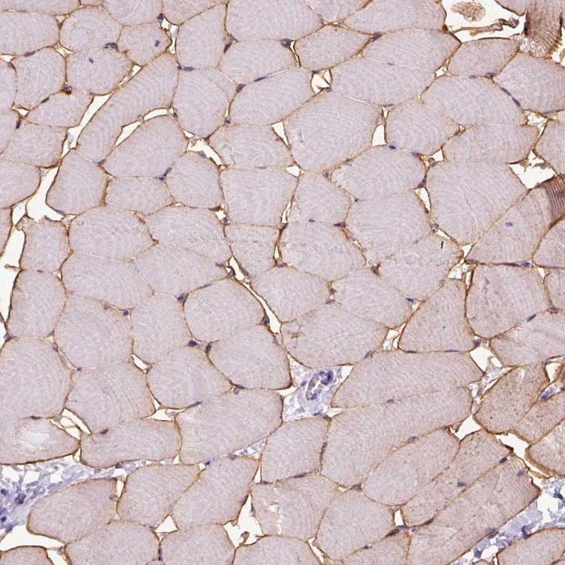 gamma Sarcoglycan Antibody - BSA Free Immunohistochemistry: gamma Sarcoglycan Antibody - BSA Free [NBP1-90299]