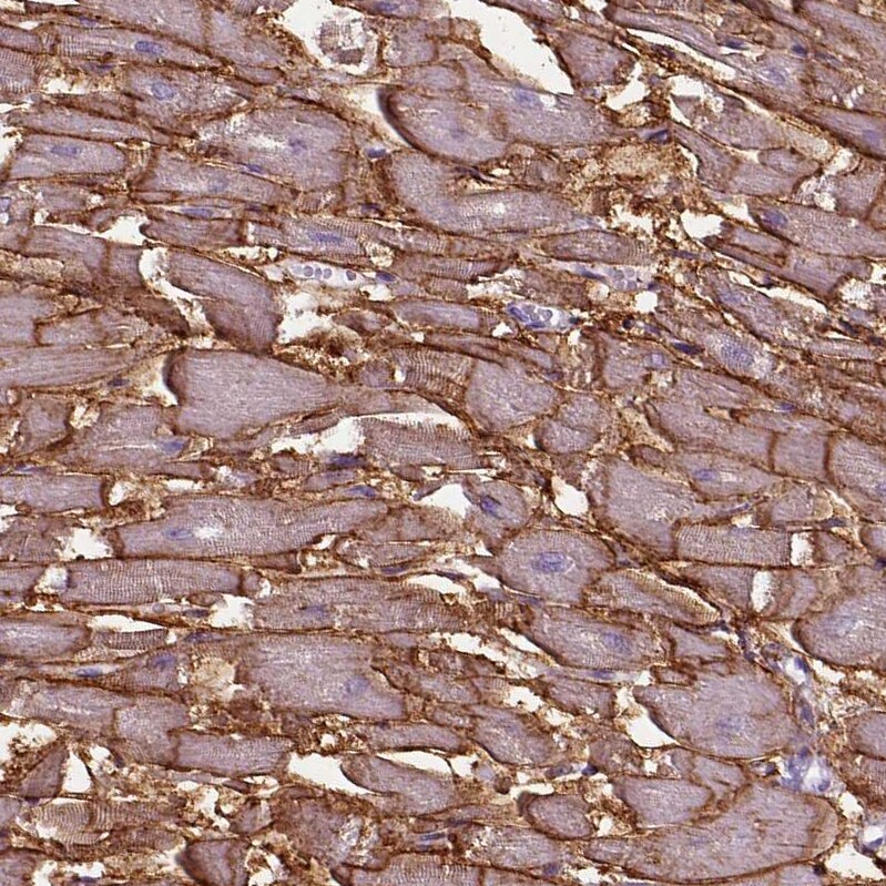 gamma Sarcoglycan Antibody - BSA Free Immunohistochemistry: gamma Sarcoglycan Antibody - BSA Free [NBP1-90299]
