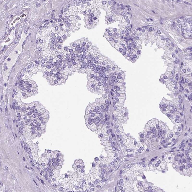 gamma Sarcoglycan Antibody - BSA Free Immunohistochemistry: gamma Sarcoglycan Antibody - BSA Free [NBP1-90299]
