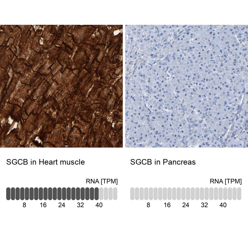 beta Sarcoglycan Antibody - BSA Free Immunohistochemistry: beta Sarcoglycan Antibody - BSA Free [NBP1-90300]