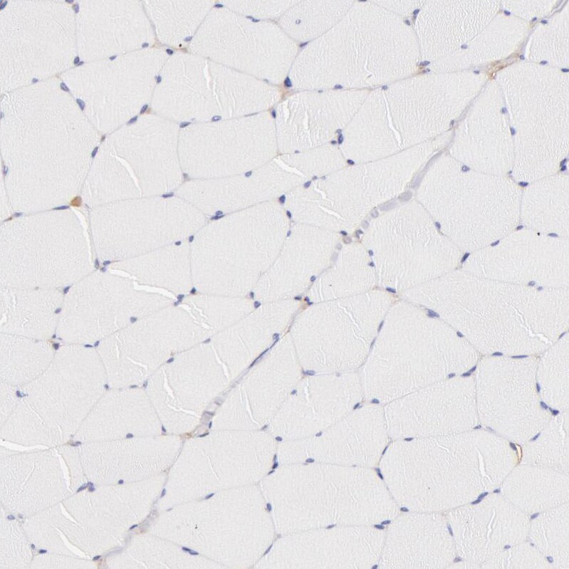 Fetuin A/AHSG Antibody - BSA Free Immunohistochemistry: Fetuin A/AHSG Antibody - BSA Free [NBP1-90302]